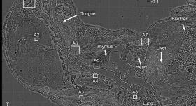 Against a grey background, a microscopic image with different parts of the human body labeled.