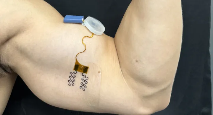 A bicep flexes, wearing a small sensor with a gold node and a blue battery cartridge.