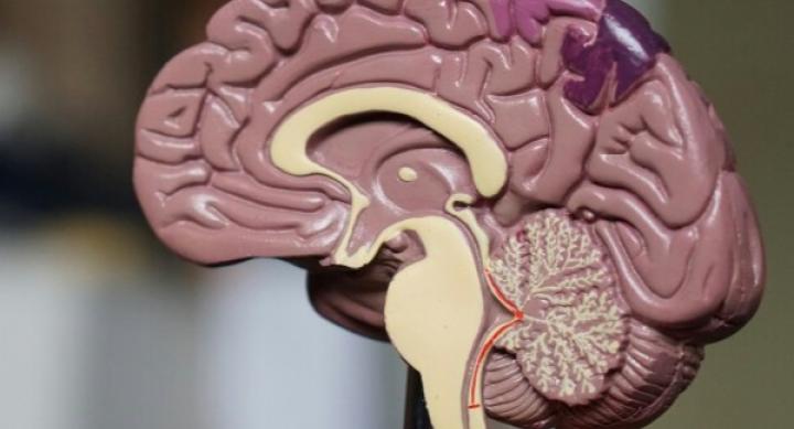 A cross sectional model of a human brain.